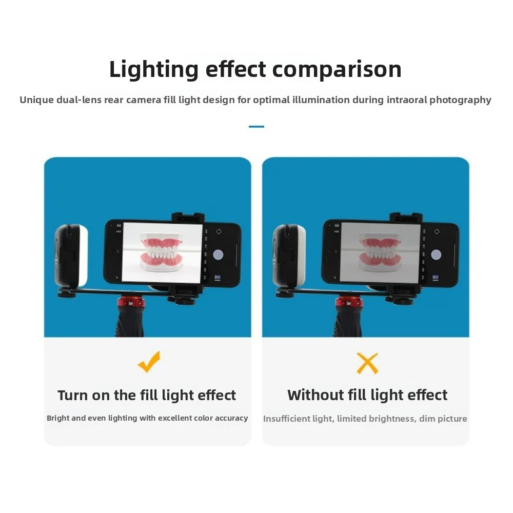 Dental Photography Light, Blue - Photography Lighting Portable บทวิจารณ์และราคา